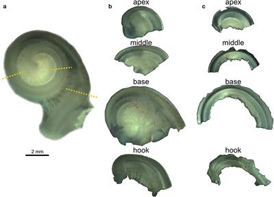 Echolocating Whales and Bats Express the Motor Protein Prestin in the Inner Ear: A Potential Marker for Hearing Loss